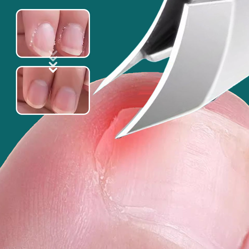 🔥Oferta 2026🔥 Cortaúñas anti-uñero con borde inclinado de 25°